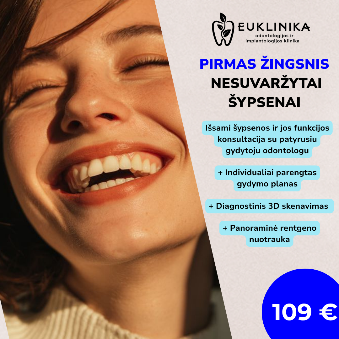 Dantų rekonstrukcijos konsultacija EUklinikoje Vilniuje su 3D skenavimu ir individualiu gydymo planu